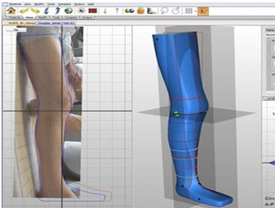 加拿大：為殘疾兒童定制3D打印假肢 