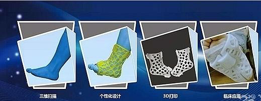 國內首個3D打印醫療中心落戶重慶