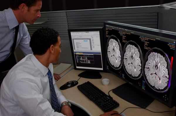 飛利浦發(fā)布其視覺分析和量化平臺(tái)的最新版本