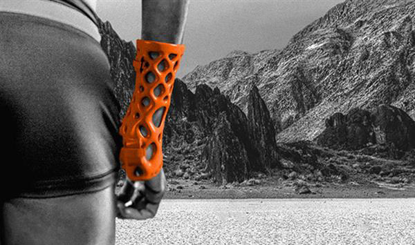 ActivArmor用3D掃描創(chuàng)建透氣防水的石膏夾板替代設備