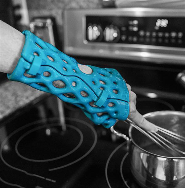 ActivArmor用3D掃描創(chuàng)建透氣防水的石膏夾板替代設備