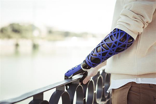 3D打印假體公司UNYQ在美國東海岸新增辦公點