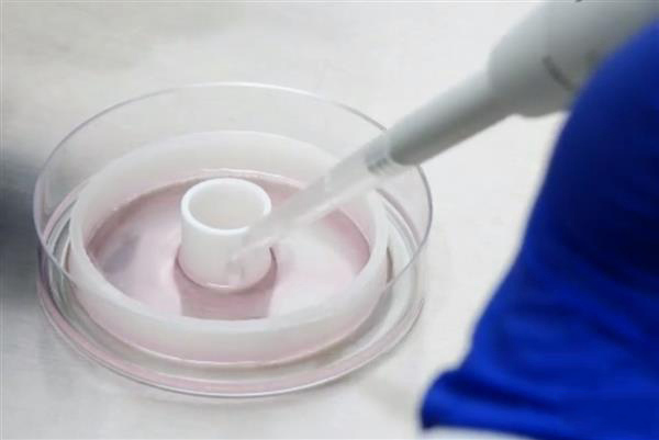 對抗心臟病的“環堆疊法”：用3D打印導板制作定制血管