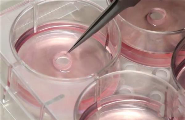 對抗心臟病的“環堆疊法”：用3D打印導板制作定制血管